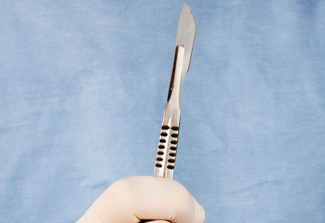Skalpel pro operaci zvětšení penisu